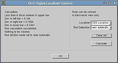 ogles localizer control