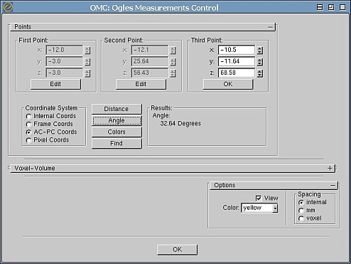 ogles measurement control