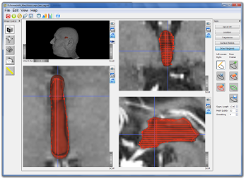 Surface Mesh Construction