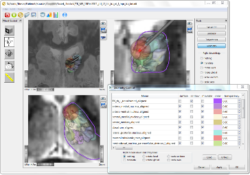 Import of Anatomical Surface Models