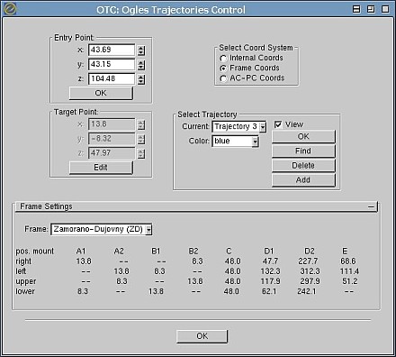 ogles trajectory control