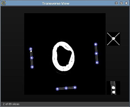 ogles localizer settings