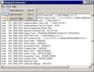 SDR Dicom header dump